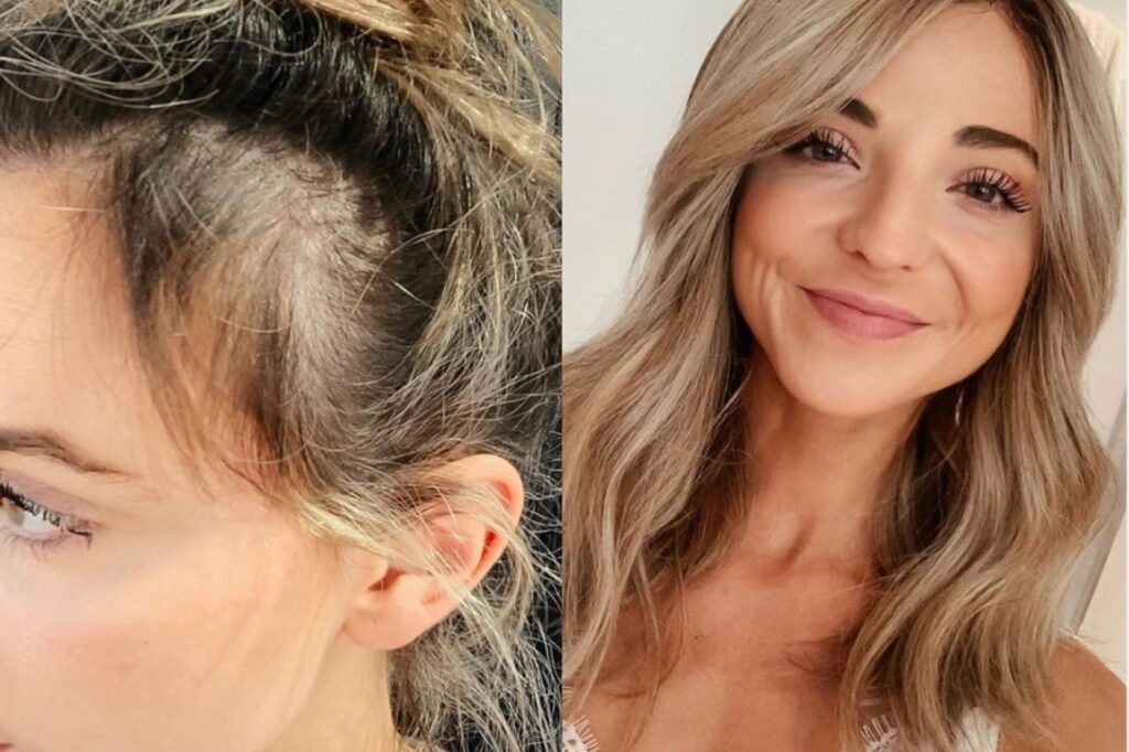 Grow Your Hair Faster With These 15 Foods